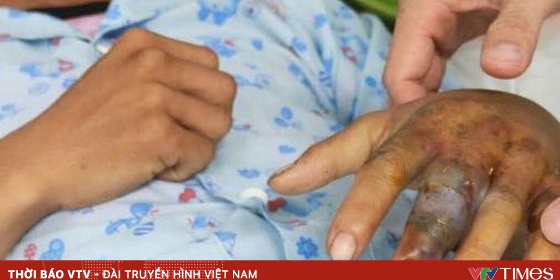 ran doc can 28691520584287841133961 40218201035570617119088.jpg