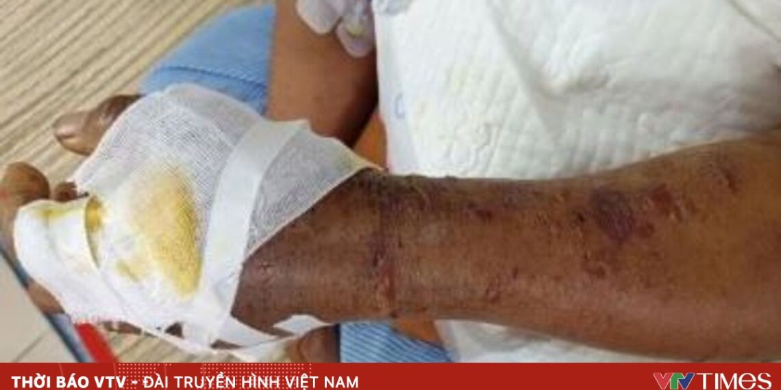 ran luc duoi do can 23257706448502410812535 89590573568177180270780.jpg