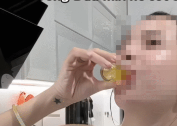 sot xinh xich uong dau o liu khi bung rong bac si noi gi 2027.png