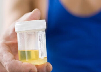 tieu bot co phai suy than 2436.jpg