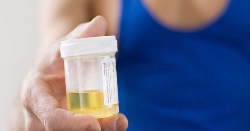 Nước tiểu nhiều bọt có phải suy thận giai đoạn cuối? tieu bot co phai suy than 2436.jpg