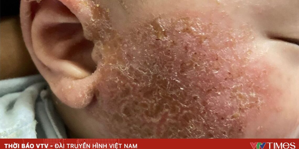 viem da 1715225312594733949756 00232837998147882318480.jpg