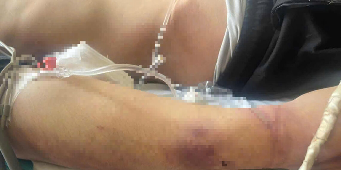 vu hoc vien tu vong sau 2 ngay nhap hoc tam dinh hoat dong cua trung tam 1315.jpeg