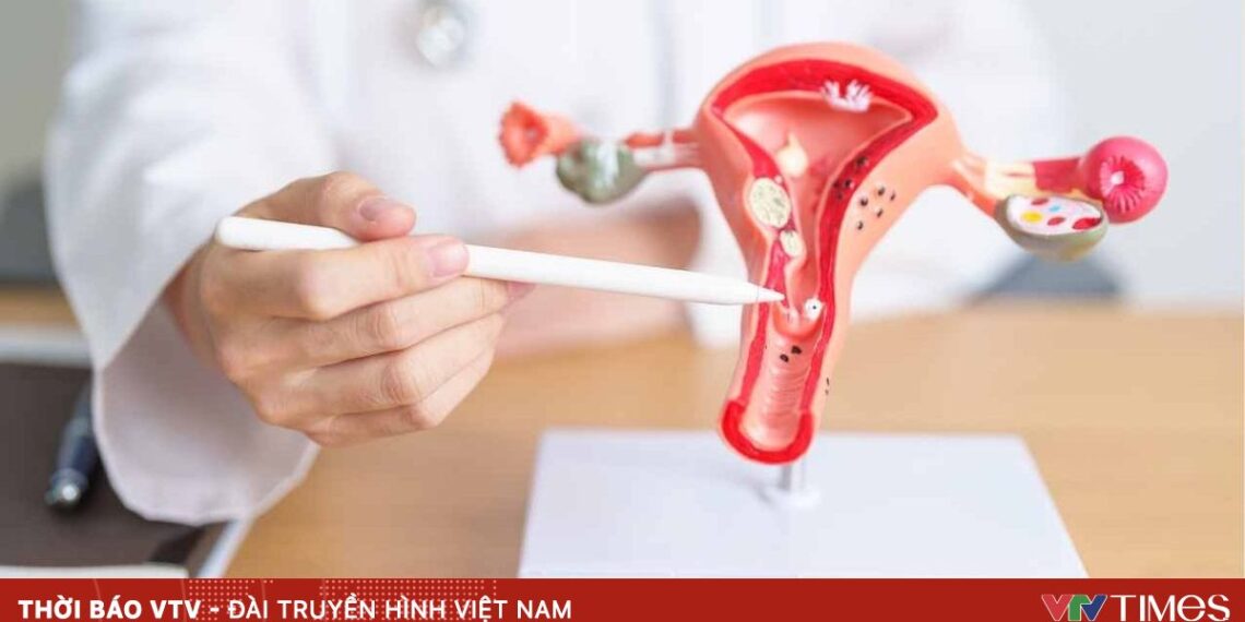 anh minh hoa 9 14819502265657299322704 99224465526748499360171.jpg