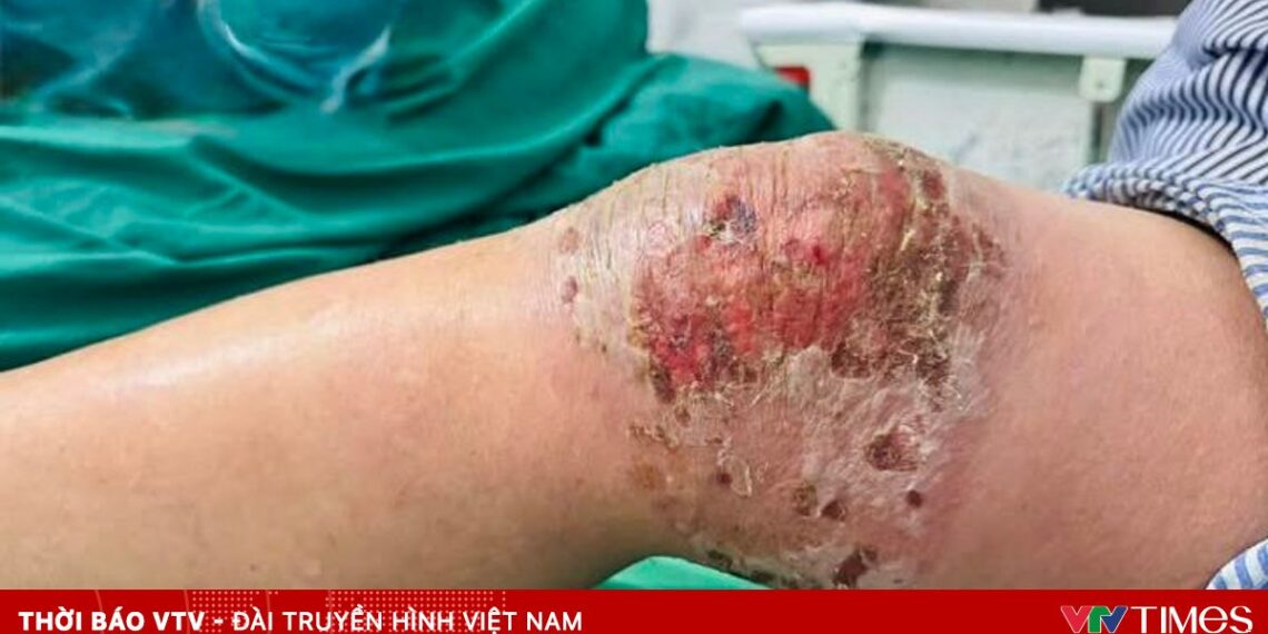 ap thuoc 21653795071934545496694 35306710916922047849610.jpg