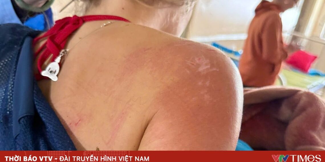 du khach bi nan 17893712537078001119561 78087939995386347181432.jpg