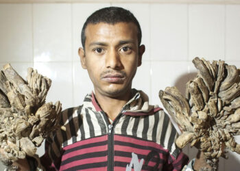 nguyen nhan khien nam thanh nien co tay chan hoa go 242.jpg