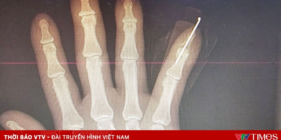 noi ngon tay 71480831203477810173794 57565448517772102797904.jpg