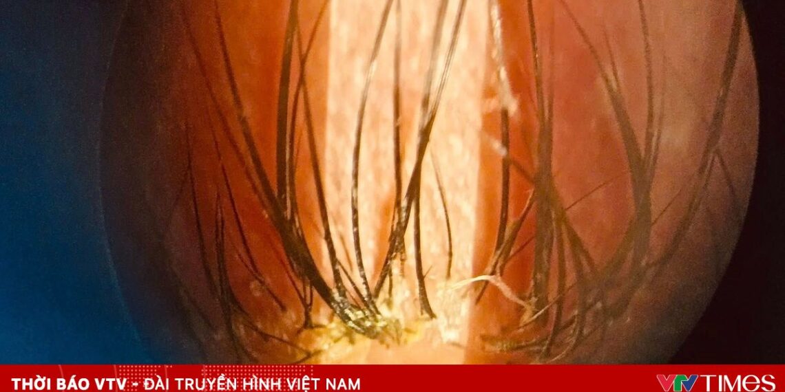 ton thuong mat 52101518349341995953441 06300584012894993490946.jpg