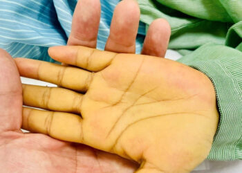 2 vi tri co mau vang canh bao nguy hiem khong nen bo qua 258.webp.jpeg