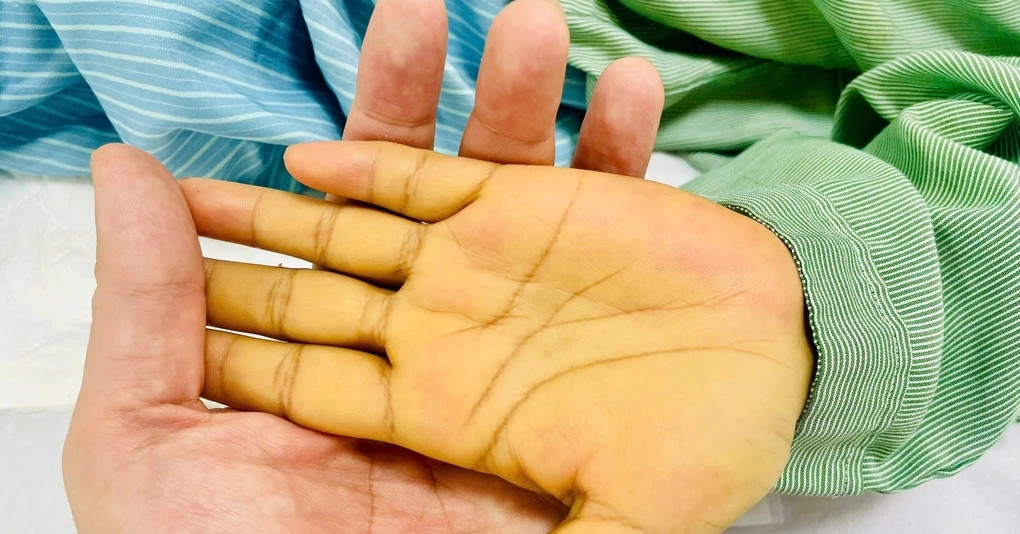 2 vị trí có màu vàng cảnh báo nguy hiểm không nên bỏ qua 2 vi tri co mau vang canh bao nguy hiem khong nen bo qua 258.webp.jpeg