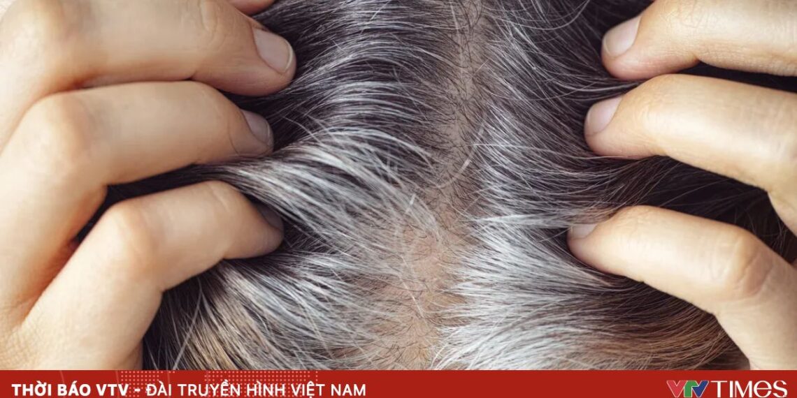 45f507bb a1d5 4b39 a0228b050a6220c8 source 36401655480729763692955 77044901608356895588514.webp.jpeg