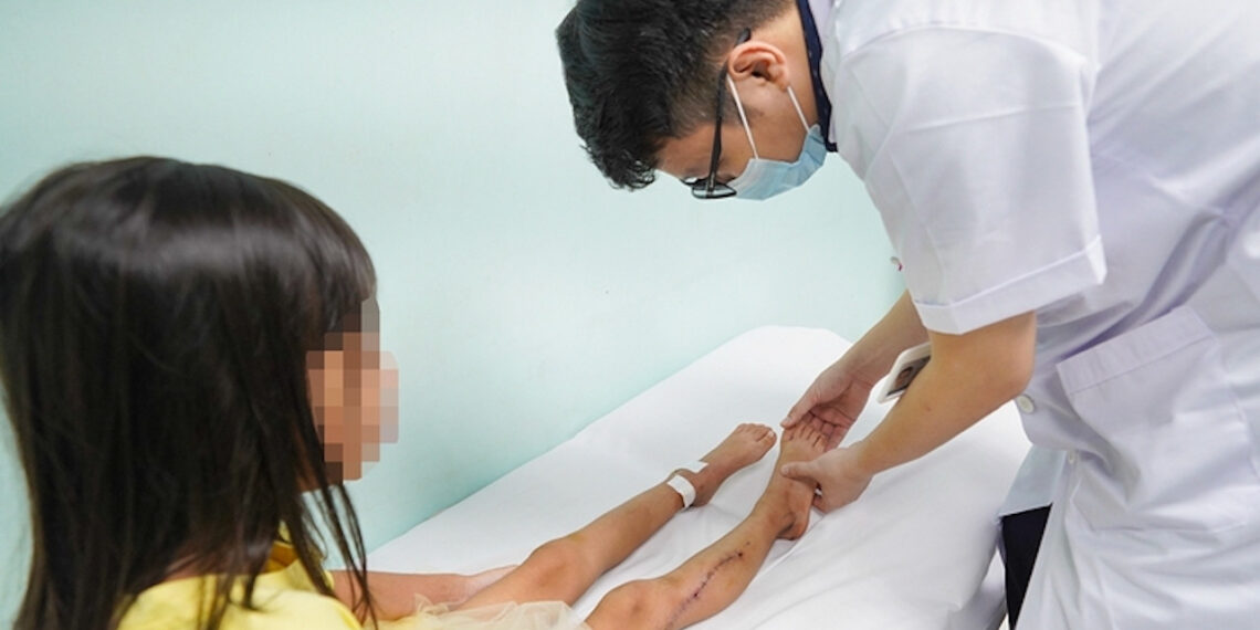 Bé gái 8 tuổi ở Hà Nội mắc ung thư ác tính từ sưng mắt cá chân be gai 8 tuoi o ha noi mac ung thu ac tinh tu sung mat ca chan 819.jpeg