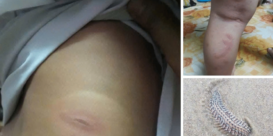 benh vien len tieng ve thong tin sau bien can be 3 tuoi nguy kich can truyen mau gap 563.png