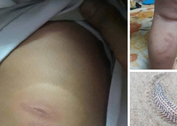 benh vien len tieng ve thong tin sau bien can be 3 tuoi nguy kich can truyen mau gap 563.png