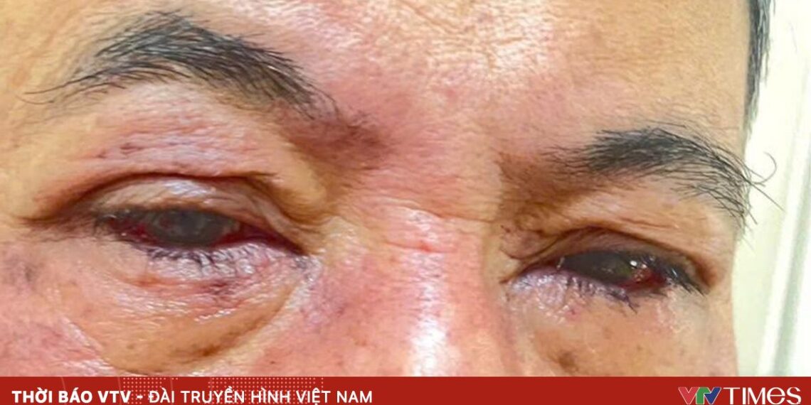 di ung thuoc 94886845507701177339859 03059349506559210431508.jpg