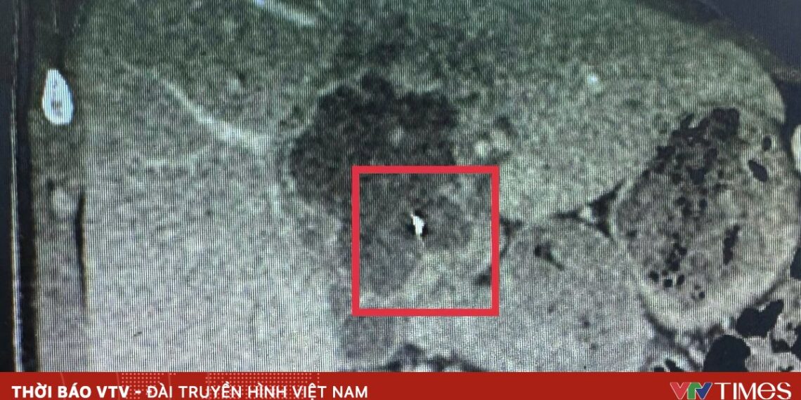 di vat kim trong gan 05018018521543480396907 86309441771339943427817.jpg