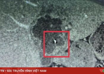 di vat kim trong gan 05018018521543480396907 86309441771339943427817.jpg