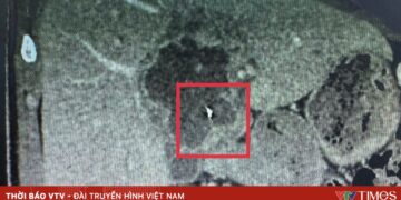 di vat kim trong gan 05018018521543480396907 86309441771339943427817.jpg