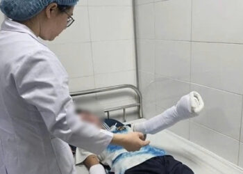 lam phao tu che theo tren mang nam sinh o thanh hoa bi no dap nat ban tay 628.jpg