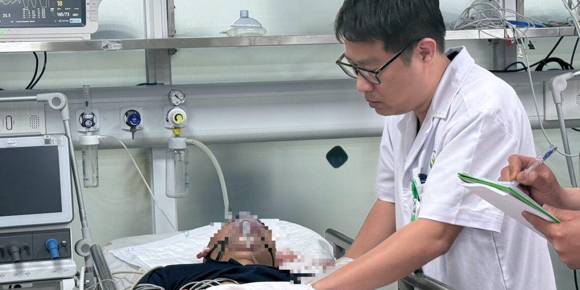 mu mat mat chi do phao no 493.jpeg