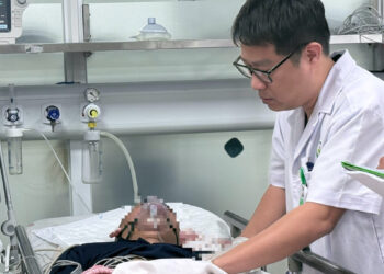 mu mat mat chi do phao no 493.jpeg