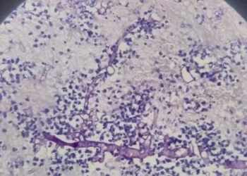 nguoi dan ong bi nam den xam lan nao 1570.webp.jpeg