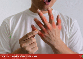 3 bệnh lý chuyển hóa thường gặp sau Tết package media 04969518875403476590209 59728105955129066767642.png