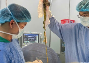 phau thuat lay bui toc khong lo chiem tron da day be trai o da nang 1312.jpg