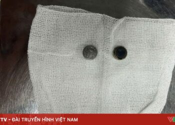 Cảnh báo trẻ nuốt dị vật nguy hiểm pin cuc ao 57429188272924257727734 39951120696750391441646.jpg