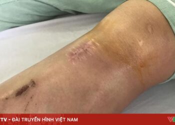 tiem khop 82720423225442410247529 78995547271344913480536.jpg