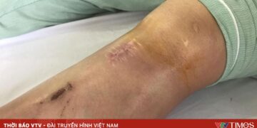 tiem khop 82720423225442410247529 78995547271344913480536.jpg