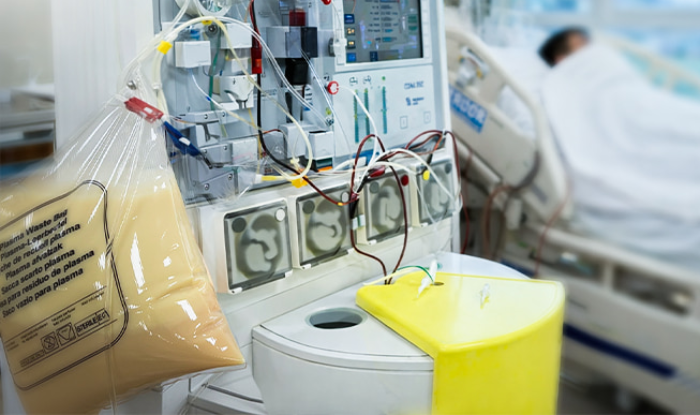 Người đàn ông nguy kịch, mỡ máu cao 48 lần sau nhiều ngày tất niên thịnh soạn viem tuy cap 1714.png