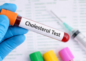 3 dấu hiệu ở mắt có thể cảnh báo mỡ máu cao từ sớm 3 dấu hiệu ở mắt có thể cảnh báo mỡ máu cao từ sớm