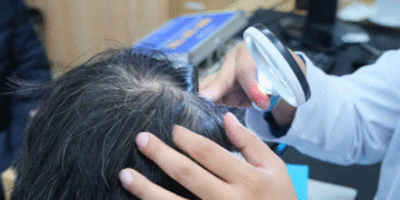 3 den 2 do giup nguoi tre ngan con bao toc bac 2505.png