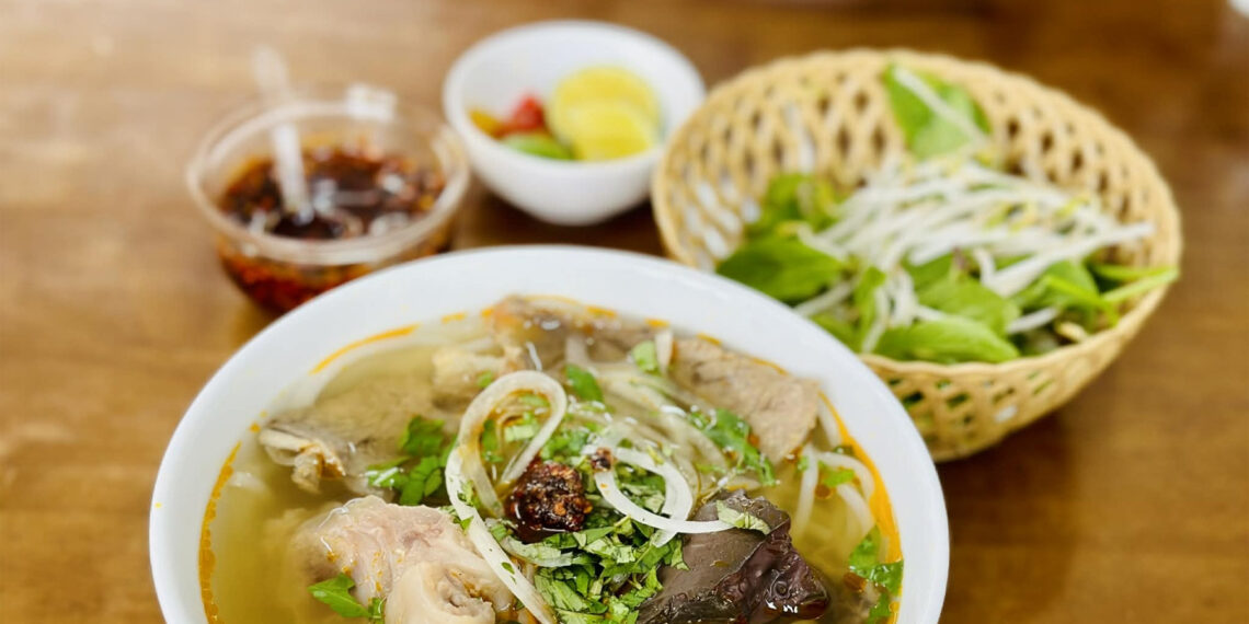 7 hành động âm thầm hủy hoại thận mà nhiều người lặp lại mỗi ngày 7 hành động âm thầm hủy hoại thận mà nhiều người lặp lại mỗi ngày