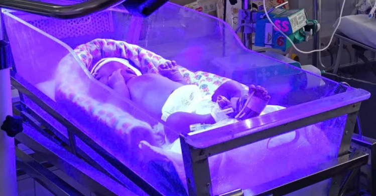 Bé trai chào đời 30 giờ đã phải 'báo động đỏ' thay máu khẩn be trai chao doi 30 gio da phai bao dong do thay mau khan 221.png