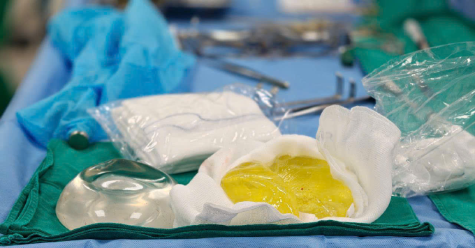 Cô gái trẻ tá hỏa vì túi ngực bỗng nhiên vỡ nát Cô gái trẻ tá hỏa vì túi ngực bỗng nhiên vỡ nát