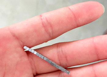 Hàng chục viên nam châm kết thành chuỗi gây thủng ruột bé trai 5 tuổi 