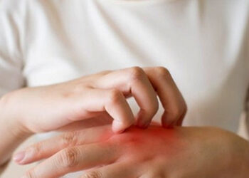 ngua keo dai vang da di kham phat hien mac cung luc 2 benh ung thu 1454.jpg