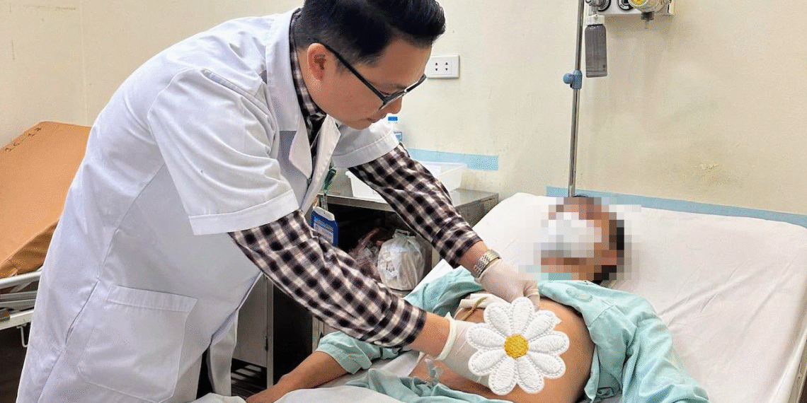 Sỏi xếp thành chuỗi hiếm gặp trong đường mật người đàn ông 46 tuổi