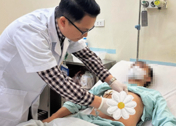 Sỏi xếp thành chuỗi hiếm gặp trong đường mật người đàn ông 46 tuổi Sỏi xếp thành chuỗi hiếm gặp trong đường mật người đàn ông 46 tuổi