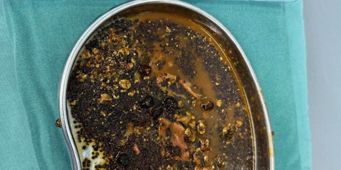 thuc hu tin don uong sua hat giam can gia tang soi mat 621.png