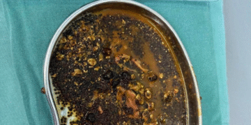 thuc hu tin don uong sua hat giam can gia tang soi mat 621.png