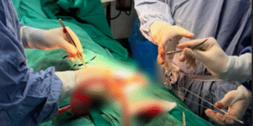 vi phau trong gio vang cuu nguoi dan ong tu cat bo phan sinh duc 266.png