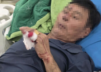 vu sa lan tong cau ghenh mot nan nhan phai phau thuat 1524.jpg