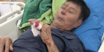 vu sa lan tong cau ghenh mot nan nhan phai phau thuat 1524.jpg