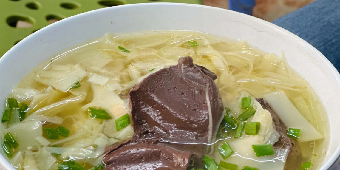 nghien cuu moi he lo tac dung cua mang voi benh tim tieu duong 2342.jpg