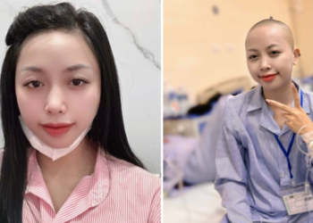 loi day dut cua nguoi phu nu tre bi ung thu di can giai doan 4 522.png