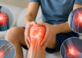 Nhóm người cần đo loãng xương ngay cả khi chưa đau nhức nhom nguoi can do loang xuong ngay ca khi chua dau nhuc 688.png